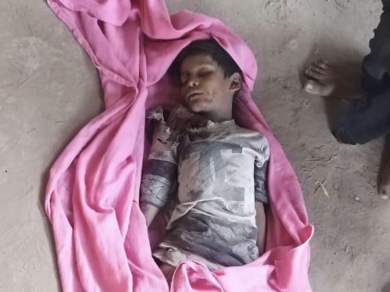 نساء وأطفال.. مليشيا الحوثي ترتكب مجزرة جديدة بحق المدنيين في حيس