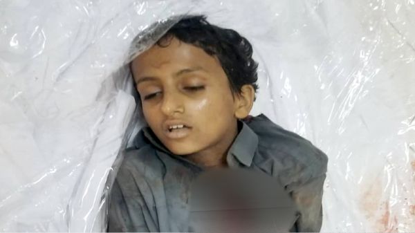 بينهم 4 أطفال... 13 شهيدًا وجريحًا من المدنيين في قصف حوثي على مأرب 