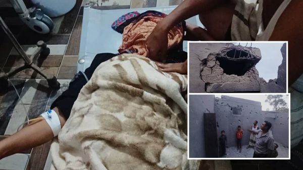 صور| إصابة نازحة وتضرر منزلها بقذيفة حوثية شرق مدينة حيس