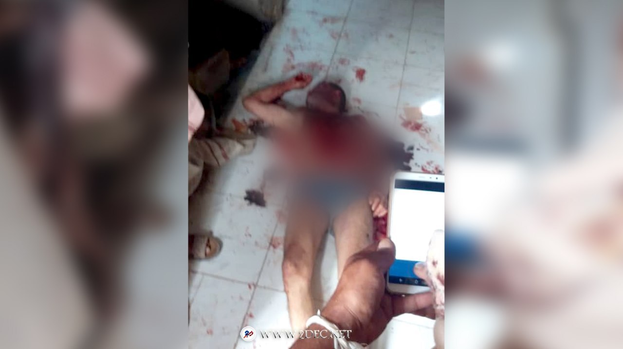 رفض دفع الجبايات فقتلوه.. مُنير ضحية جديدة لغدر مليشيا الحوثي