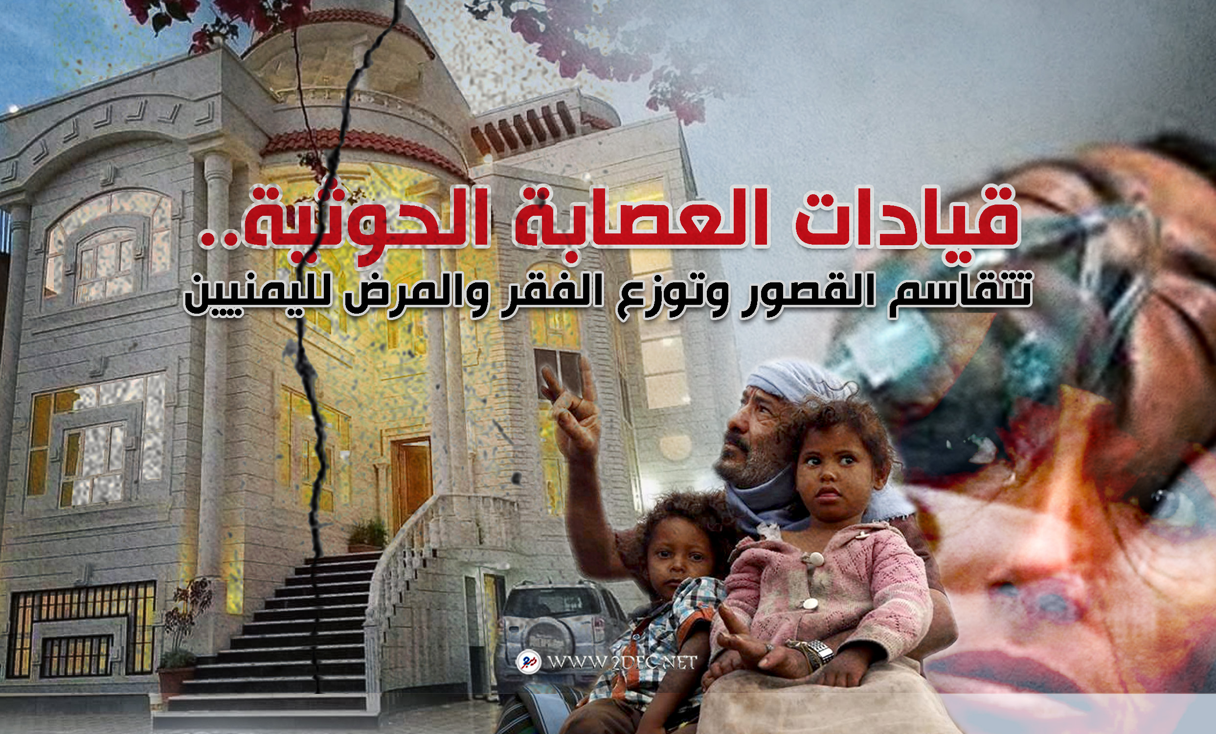 قيادات العصابة الحوثية.. تتقاسم القصور وتوزع الفقر والمرض لليمنيين 