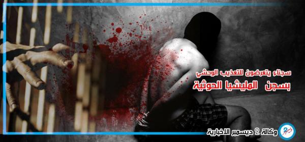 معتقلون لدى المليشيا يتعرضون للتعذيب الوحشي بسجن الأمن السياسي بصنعاء