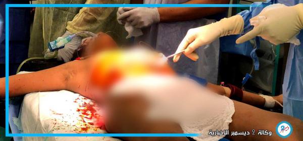 حصيلة مروعة لمجزرة جديدة ارتكبتها مليشيا الإرهاب الحوثية بحق المدنيين في مدينة التحيتا