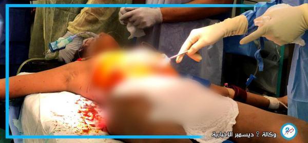 وكالة 2 ديسمبر تنشر أسماء الشهداء المدنيين في قصف مليشيا الإرهاب الحوثية أمس على مدينة التحيتا
