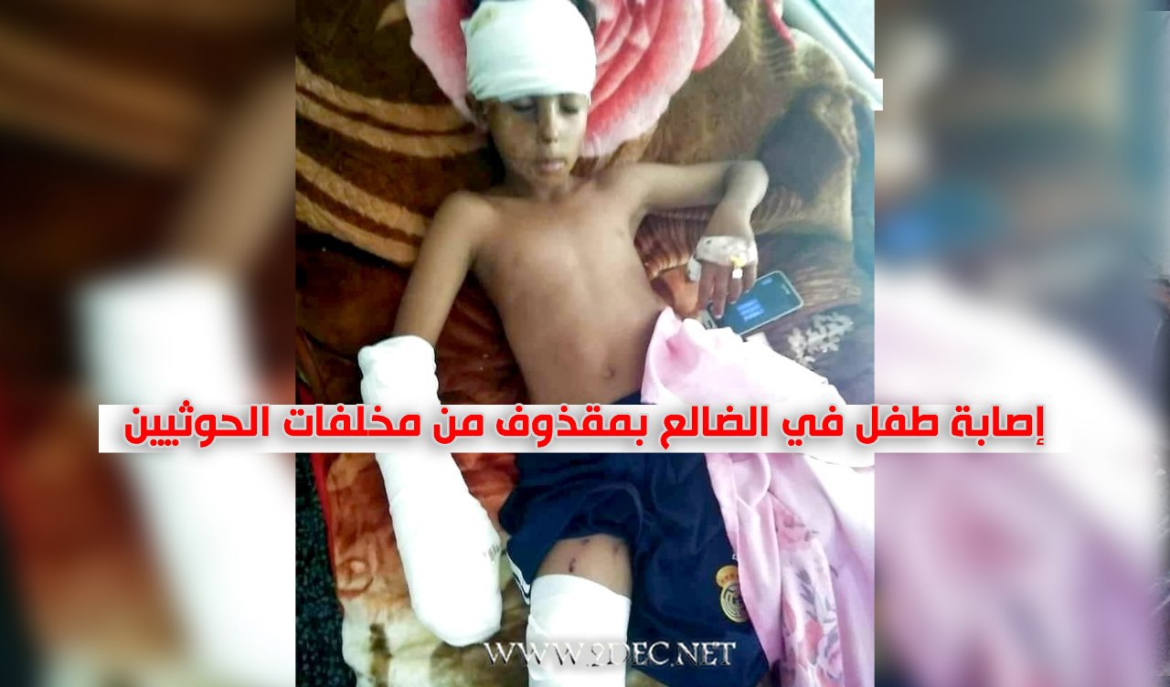 إصابة طفل في الضالع بمقذوف من مخلفات الحوثيين