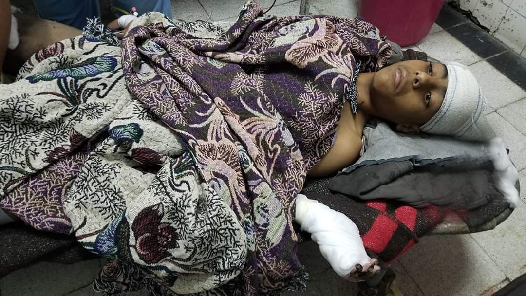 إصابة طفل إثر انفجار لغم من مخلفات الحوثيين بتعز