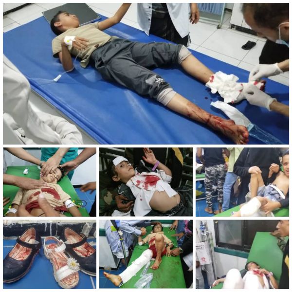 تعز.. أسماء ضحايا مجزرة مليشيا الحوثي 