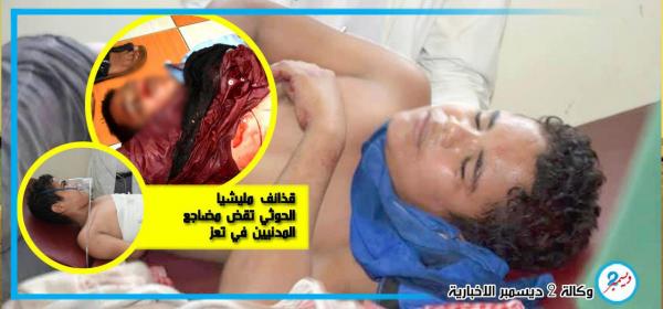 قذائف مليشيا الإرهاب الحوثية تقض مضاجع المدنيين في تعز