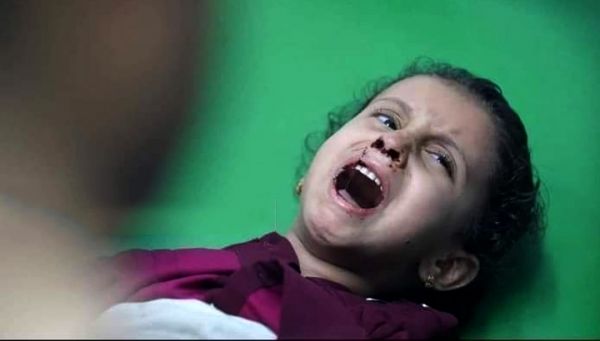 تقرير| تعز.. ما بعد مجزرة حي الروضة