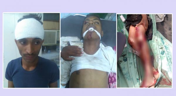تفاصيل جديدة عن جريمة مليشيا الحوثي بحق أهالي "سويهرة" في مقبنة 