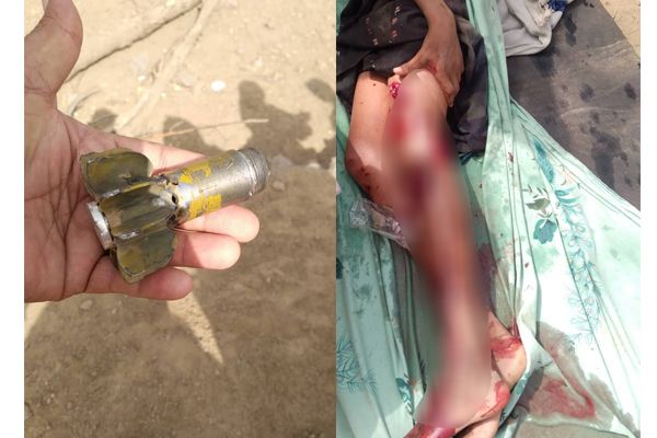 جريمتان بحق المدنيين خلال 5 ساعات.. قصف صاروخي حوثي يباغت أهالي قرية في مقبنة بعد استهداف مماثل لقرية في حيس 