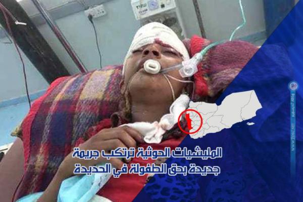 فيديو.. المليشيات الحوثية ترتكب جريمة جديدة بحق الطفولة في الحديدة