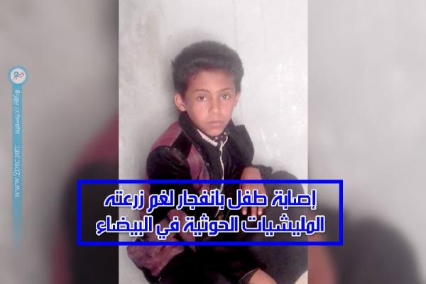 إصابة طفل بانفجار لغم زرعته المليشيات الحوثية في البيضاء