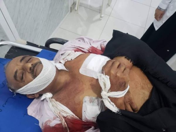 أول ضحايا تمديد الهدنة.. شهيد مدني في تعز برصاصة قناص حوثي 