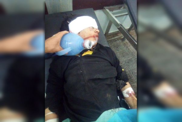 إصابة شابة بجروح بليغة في الضالع إثر تعرضها لعملية قنص حوثية