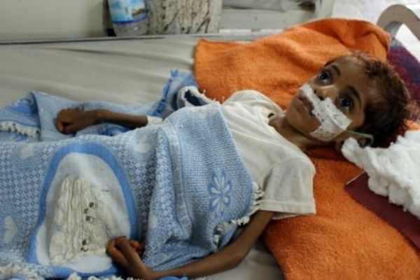 ذكر أنهما تجاوزا "عتبة الطوارئ".. تقرير أممي يحذِّر: المجاعة تهدد حجة والحديدة 