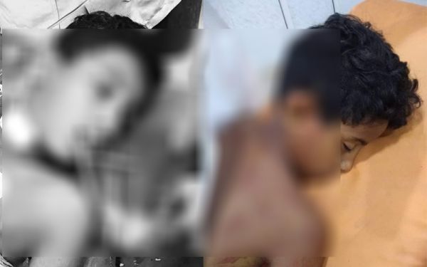 الطفل النازح "بائع المناديل" يلقى حتفه برصاص مسلح يتبع شيخا حوثيا وسط إب