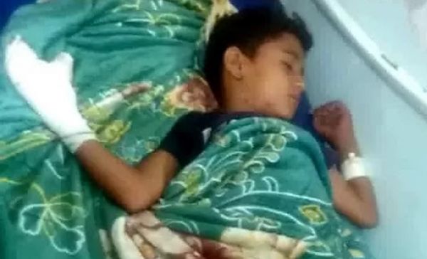 إصابة ثلاثة أطفال بانفجار مقذوف حوثي في مديرية "الضالع"
