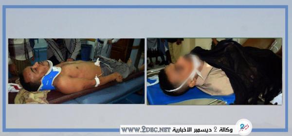 مليشيا الحوثي تقتل مدنيا وتصيب آخر صبيحة العيد شرق تعز