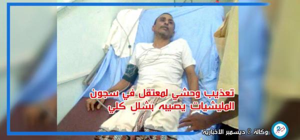 تعذيب وحشي لمعتقل في سجون المليشيات يصيبه بشللٍ كلي