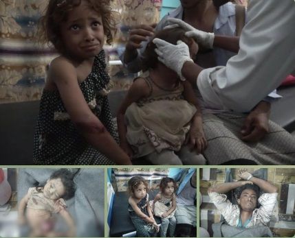 جريمة بشعة لمليشيا الحوثي في حيس تسفر عن سقوط 4 شهداء وجرحى أغلبهم أطفال