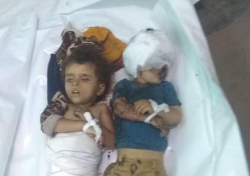 استشهاد طفلين شقيقين بقصف حوثي على حي سكني بمدينة تعز