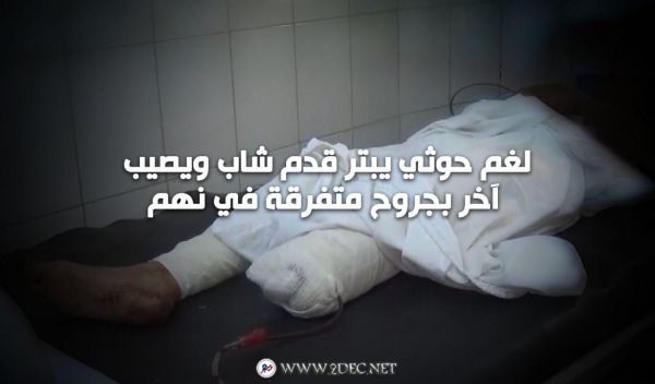 لغم حوثي يبتر قدم شاب ويصيب آخر بجروح متفرقة في نهم