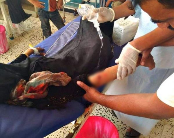 قناصان حوثيان يصيبان امرأتين في جريمتين منفصلتين بالضالع
