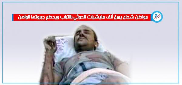 مواطن شجاع يمرغ أنف مليشيات الحوثي بالتراب ويحطم جبروتها الواهن