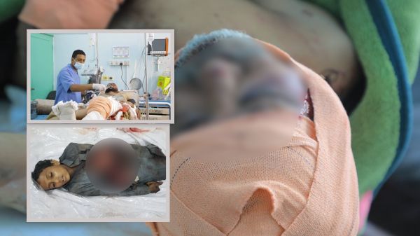 تحالف حقوقي: مليشيا الحوثي قتلت وأصابت 2032 مدنيًا في مأرب
