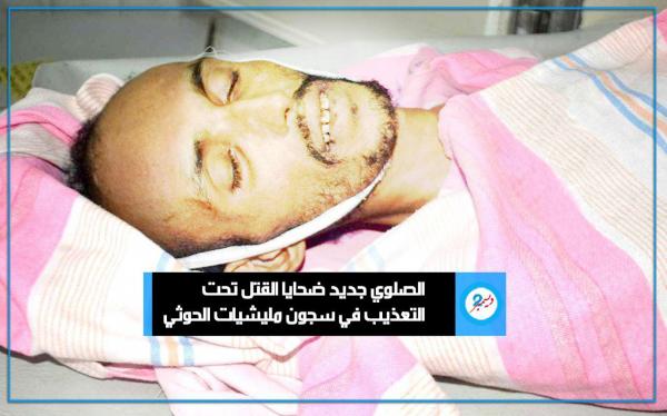 عامان من الإخفاء القسري.. تعذيب معتقل حتى الموت في سجون الميليشيا الحوثية