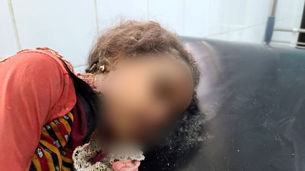 "اليونيسف" عن مقتل أطفال بهجوم صاروخي حوثي على مأرب: خرق للقانون الإنساني الدولي