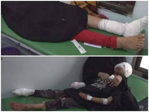إصابة طفلتين بانفجار لغم من مخلفات مليشيا الحوثي في تعز