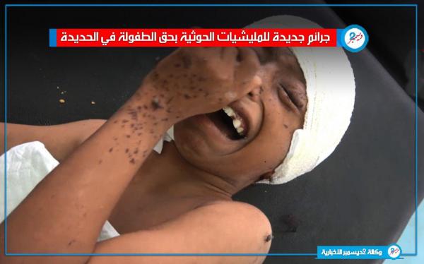 «فيديو» - جرائم جديدة للمليشيات الحوثية بحق الطفولة في الحديدة 