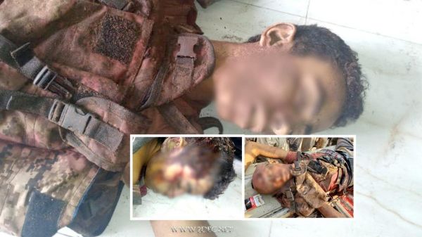 صور| الحديدة.. تجدد المواجهات ومصرع وجرح عشرات الحوثيين