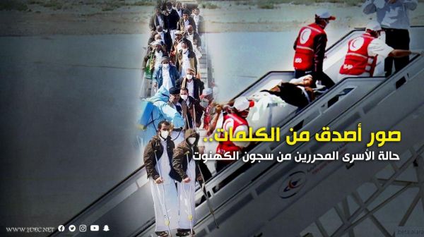 صور أصدق من الكلمات.. حالة الأسرى المحررين من سجون الكهنوت الحوثي