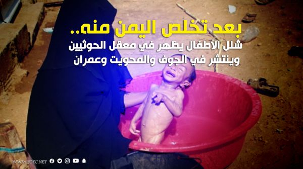 شلل الأطفال يظهر في معقل الحوثيين وينتشر في الجوف والمحويت وعمران
