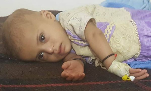 أطفال اليمن وفقا لـ(يونيسف).. أربعة من بين خمسة بحاجة لمساعدة والقتلى والجرحى تجاوزوا عشرة آلاف