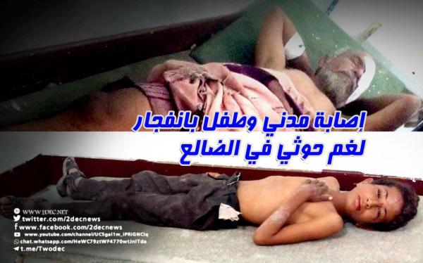 إصابة مدني وطفل بانفجار لغم حوثي في الضالع