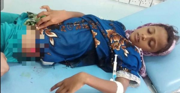 إصابة طفلة في قصف حوثي على منازل الجبلية في التحيتا