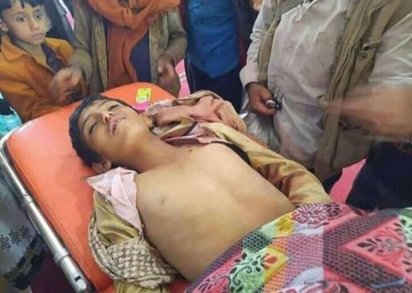 استشهاد طفل برصاص قناص حوثي في مريس الضالع