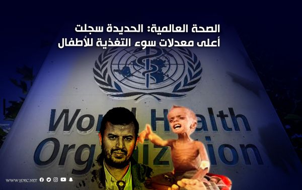 الصحة العالمية: الحديدة سجلت أعلى معدلات سوء التغذية للأطفال