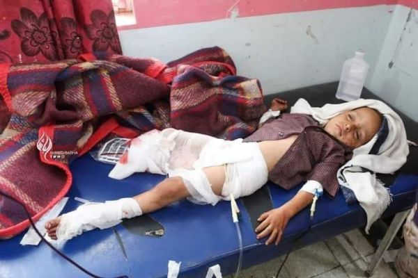 مجزرة حوثية بتعز ضحيتها أطفال.. استشهاد ثلاثة أشقاء وإصابة خمسة بجروح خطيرة