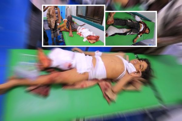 أغلبهم أطفال.. ثلاث جرائم متتالية للحوثيين بتعز تخلّف شهيدًا و6 جرحى 