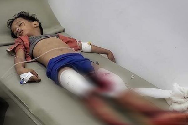 متأثراً بإصابته.. استشهاد طفل بعد 24 ساعة من استشهاد والده بجريمة حوثية في تعز 