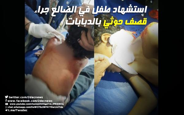 استشهاد طفل في الضالع جراء قصف حوثي بالدبابات