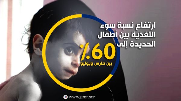 ارتفاع نسبة سوء التغذية بين أطفال الحديدة إلى 60٪ بين مارس ويوليو 