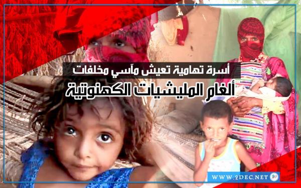 قصة أسرة تهامية تعيش مآسي مخلفات ألغام المليشيات الكهنوتية