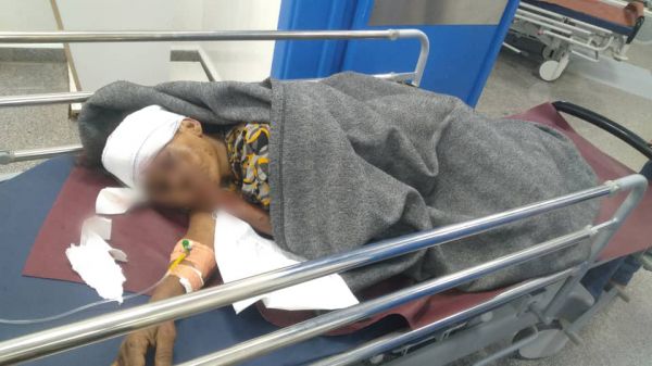 حمار ينقذ امرأة من موت محقق بلغم حوثي غربي تعز