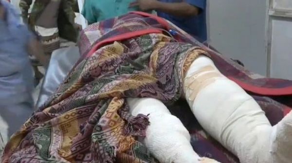 إصابة امرأة في التحيتا إثر قصف عدواني حوثي 